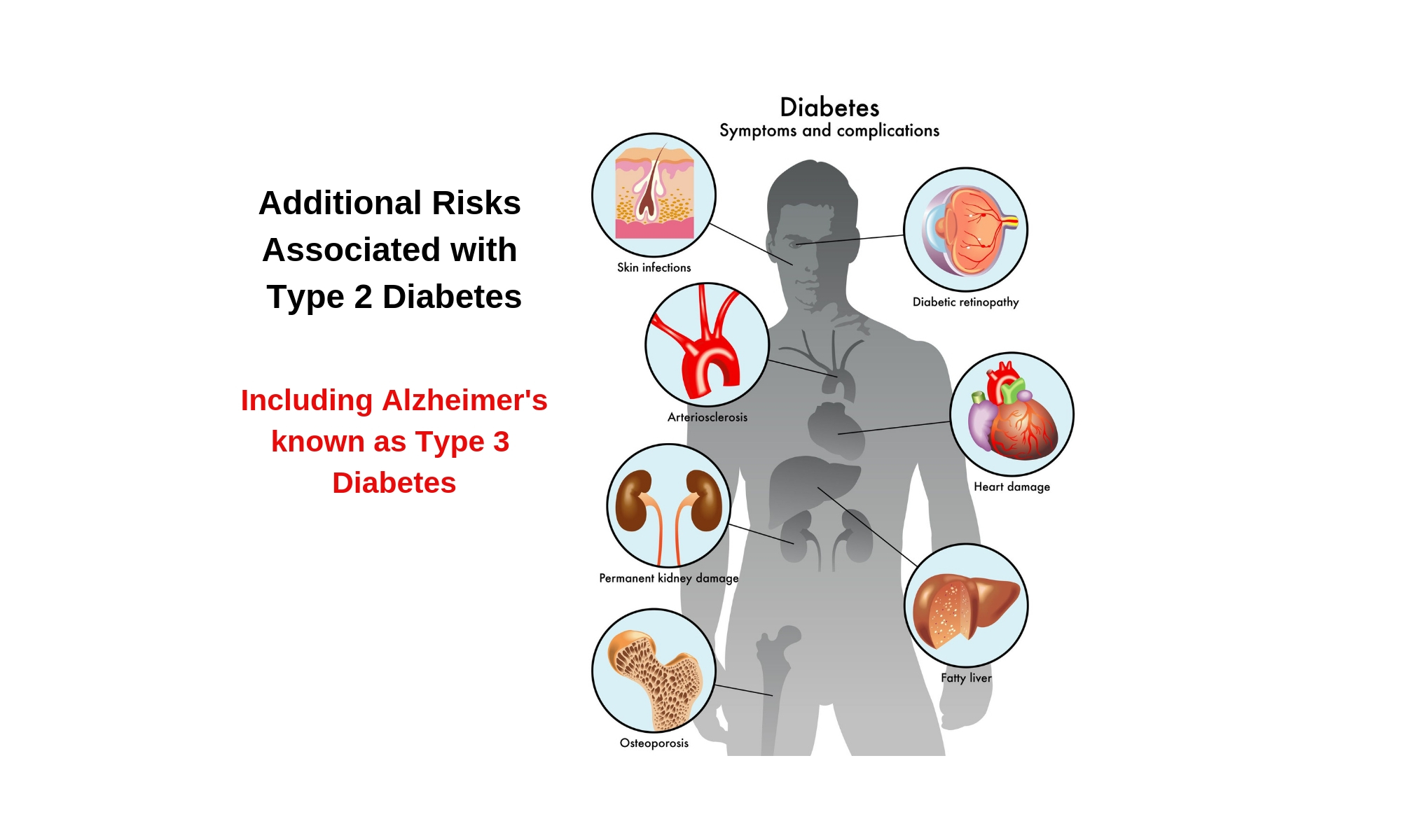 complications-of-diabetes-reversing-type-2-diabetes-weight-loss